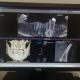 3D Dental Rayscan Alpha Plus 13x10 con Tele